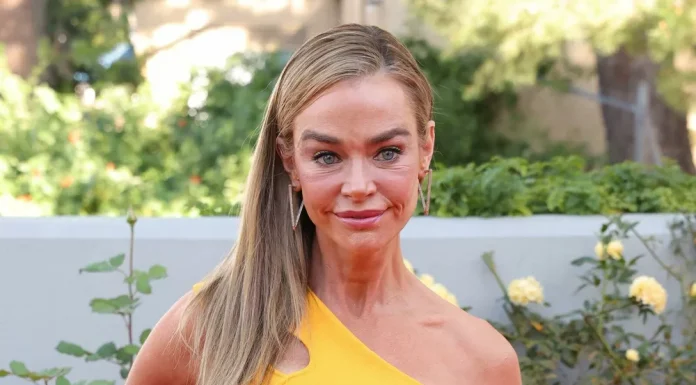 Denise Richards had a facelift