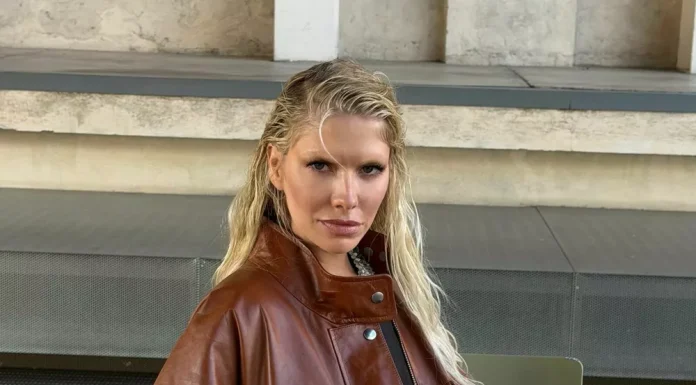 Elena Perminova admitted that she gained weight due to an injury.