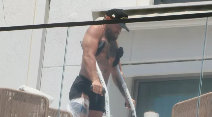 Conor McGregor after knee surgery: new photos